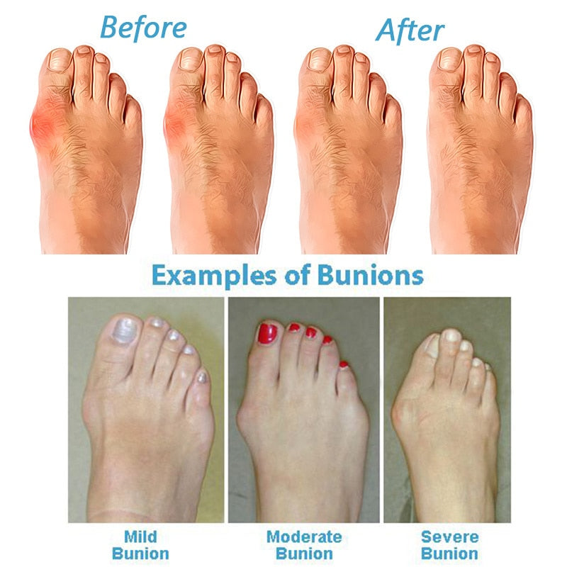 Cushioned platform gives height without joint strain